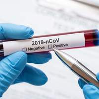 Оперативна інформація щодо захворювання на коронавірусну інфекцію станом на 29 травня