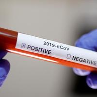 В Україну прибули 250 000 експрес-тестів на коронавірус з Китаю