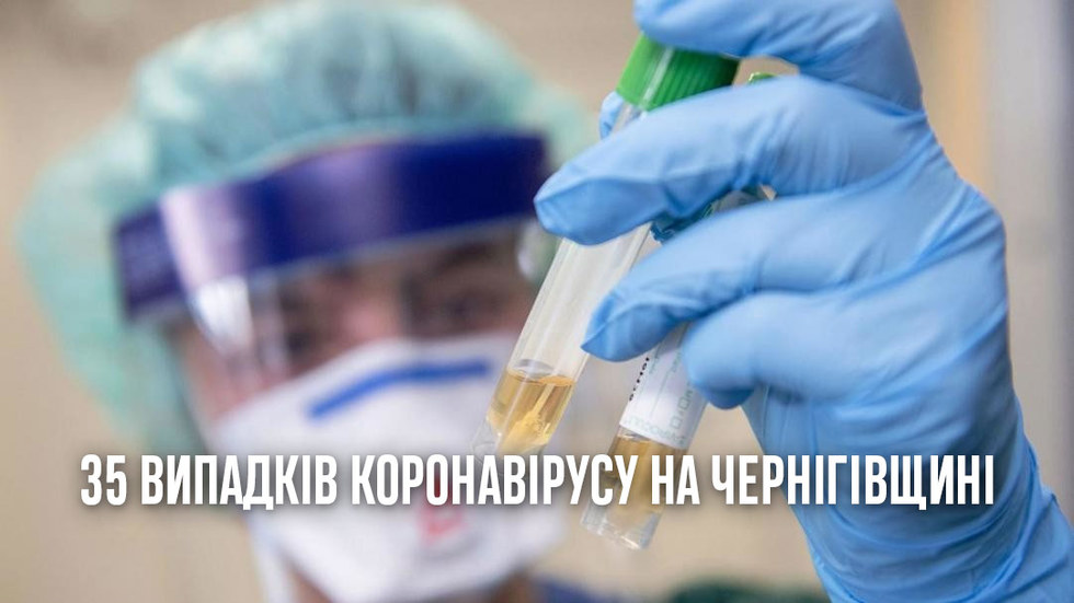 На Чернігівщині вже 35 випадків коронавірусу
