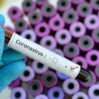 Оперативна інформація щодо захворювання на коронавірусну інфекцію станом на 25 травня