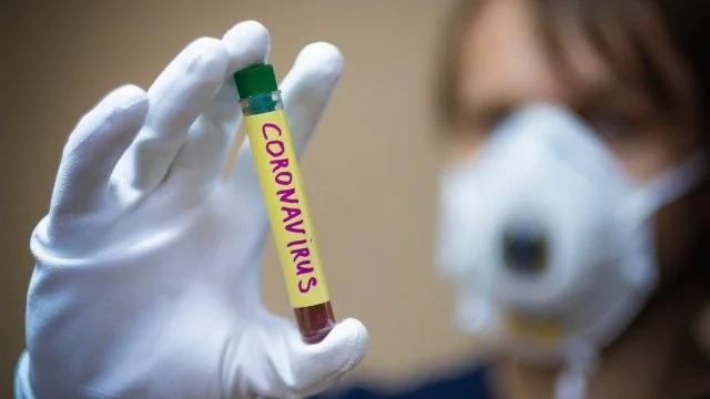 За останню добу в Чернігівській області +3 випадки захворювання на коронавірусну інфекцію