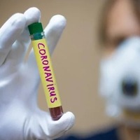 За останню добу в Чернігівській області +3 випадки захворювання на коронавірусну інфекцію