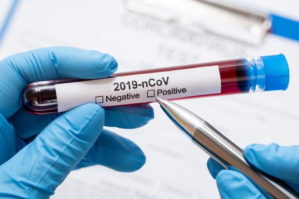 Оперативна інформація щодо захворювання на коронавірусну інфекцію станом на 2 червня