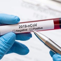 У Чернігівській області зафіксовано +57 нових випадків захворювання COVID-19 за останніх два дні