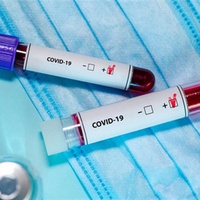 Три антирекорди COVID одразу - за добу в Україні 2134 нових хворих