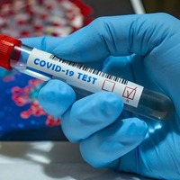 Станом на ранок 11 жовтня коронавірус виявили ще у 4768 людей в Україні