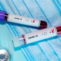 У Чернігівській області виявлено 78 нових випадків COVID-19 станом на 2 листопада