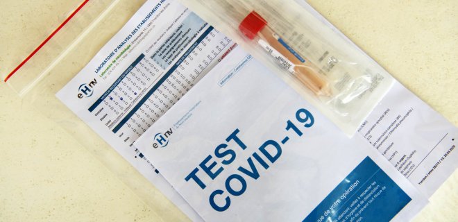 У МОЗ закликали українців робити тест на COVID-19 за будь-яких симптомів ГРВІ