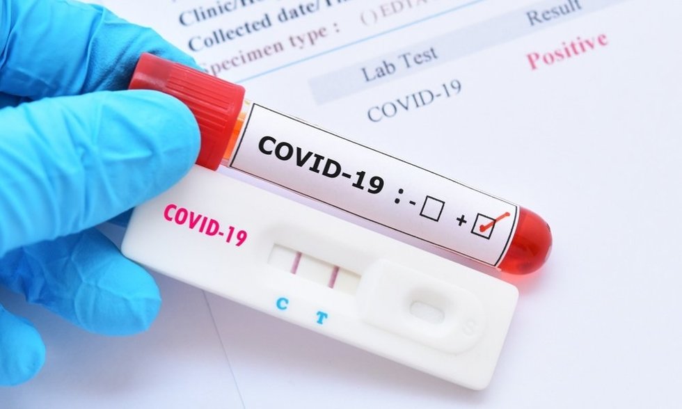 У Чернігівській області виявлено 13 нових випадків COVID-19