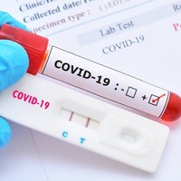У Чернігівській області виявлено 399 нових випадків COVID-19