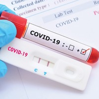 В Чернігівській області виявлено 587 нових випадків COVID-19 станом на 18 квітня