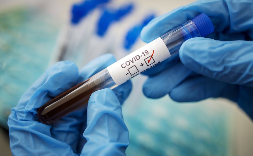 В Україні зафіксували перший випадок зараження штамом коронавірусу «Кракен»