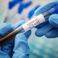 В Україні зафіксували перший випадок зараження штамом коронавірусу «Кракен»